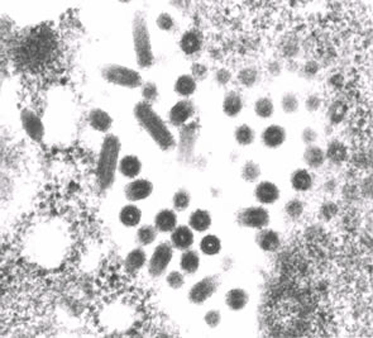 VHS virus; Photo: Mohmmed Faisal