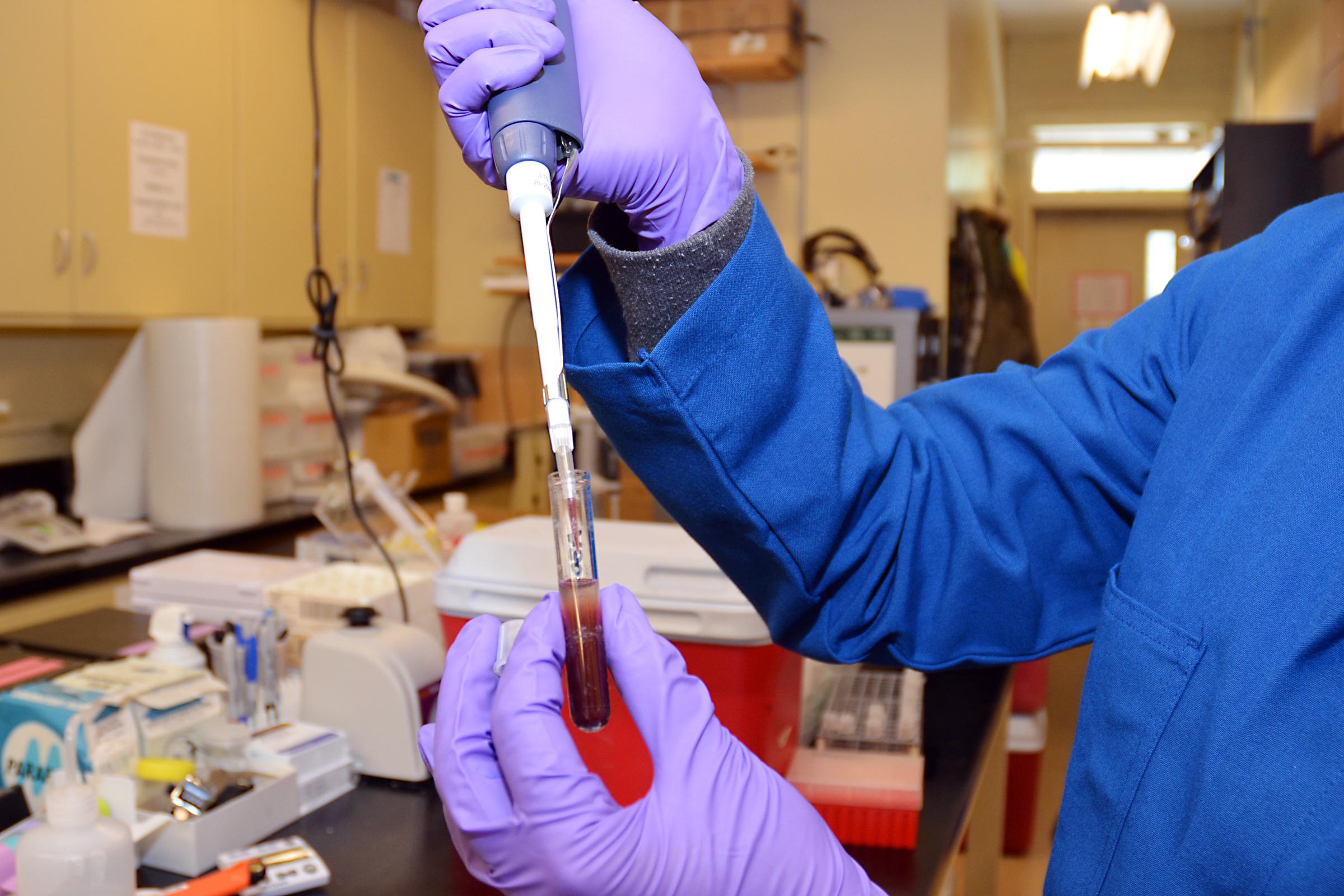 Triploidization to Improve Sturgeon Caviar Production - Prepping blood for flow and Coulter